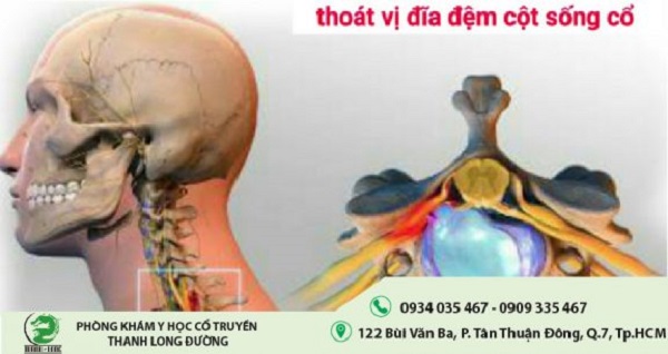 thoat-vi-dia-dem-cot-song-co