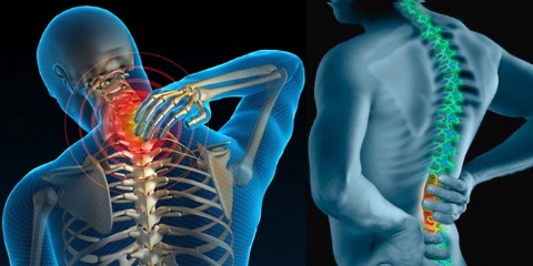 Triệu chứng thoát vị đĩa đệm cột sống cổ